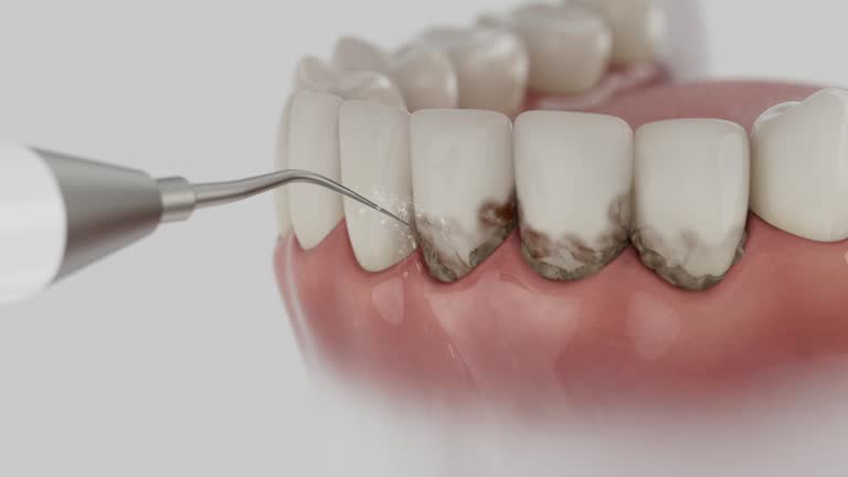 Reliable Dental contractor in Cedar Heights, MD by Smile Center Dentistry